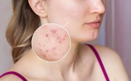 ଖରାଦିନେ ସ୍କିନ୍‌ ଆଲର୍ଜିର ଘରୋଇ ଚିକିତ୍ସା