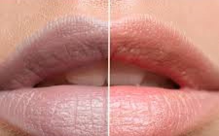 ଘରୋଇ ଉପାୟରେ ଓଠକୁ ଗୋଲାପି କରନ୍ତୁ