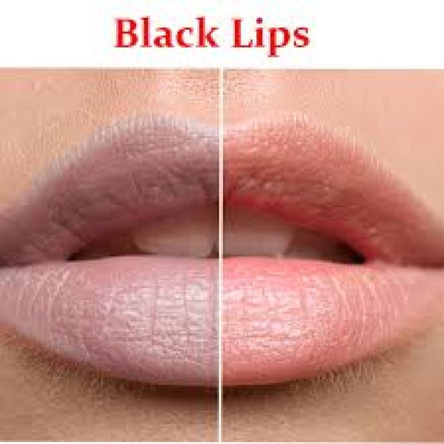 ଘରୋଇ ଉପାୟରେ ଓଠକୁ ଗୋଲାପି କରନ୍ତୁ