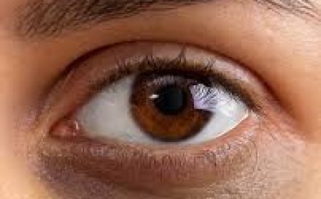 ଆଖି ତଳେ କଳାଦାଗ ପଡୁଛି କି ?  ଏହି  ଘରୋଇ ଉପାୟ ଆପଣାନ୍ତୁ