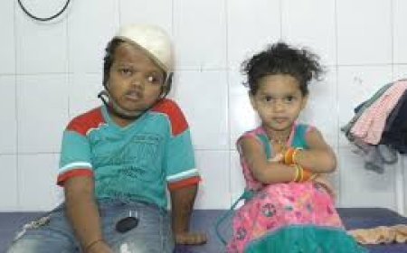 ଯୋଡ଼ାମୁଣ୍ଡ ଅଲଗା ଶିଶୁ ଜଗା ହାତରେ ରାଖୀ ବାନ୍ଧିଲା ଭଉଣୀ