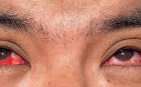 ଜାଣନ୍ତୁ…ମଣିଷକୁ ବାର୍ଡ ଫ୍ଲୁ ହେଲେ କେଉଁସବୁ ଲକ୍ଷଣ ଦେଖାଯାଏ ?