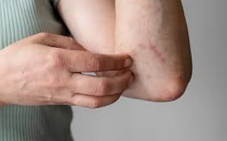 ଚର୍ମ ସଂକ୍ରମଣ ରୋକିବାର ଉପାୟ ଜାଣନ୍ତୁ