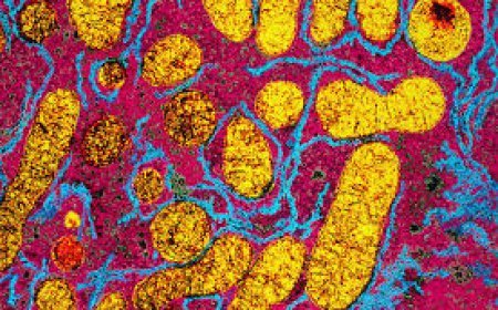 ମେଟାବୋଲିଜିମ୍  କେମିତି ବଢାଇବେ ?