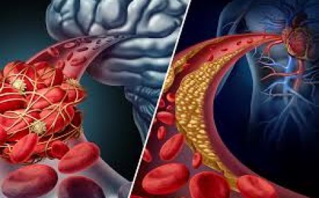 ହାର୍ଟ ଷ୍ଟ୍ରୋକରୁ ଦୂରେଇ ରହିବାକୁ ଚାହୁଁଛନ୍ତି ?