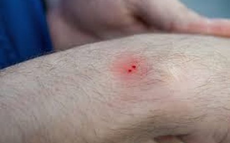 ପ୍ରଧାନ ଶିକ୍ଷୟତ୍ରୀ ନିଲମ୍ବିତ: ପିପିଲି ପୋପୋରଙ୍ଗା ସ୍କୁଲର ଛାତ୍ରକୁ ସାପ କାମୁଡିବା ଘଟଣା