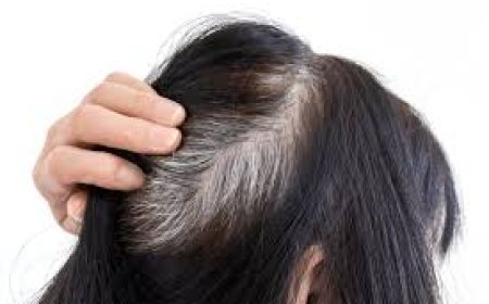 ଧଳା କେଶ ପାଇଁ ଚିନ୍ତିତ କି?