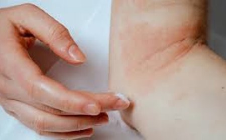 ଆଜ୍‌ମାରୁ ମୁକ୍ତି ପାଇଁ ଘରୋଇ ଉପଚାର