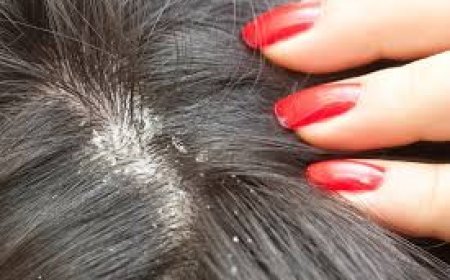 ରୁପି ହେବାର ବିଭିନ୍ନ କାରଣ ରହିଛି