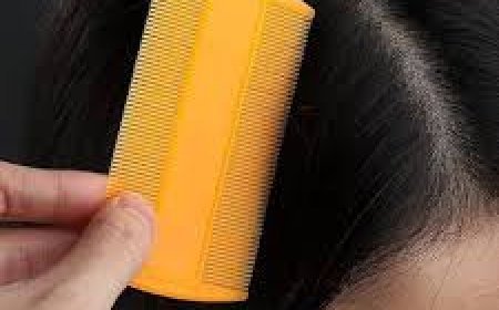 କିଭଳି ପାଇବେ ଉକୁଣୀ ସମସ୍ୟାରୁ ମୁକ୍ତି?