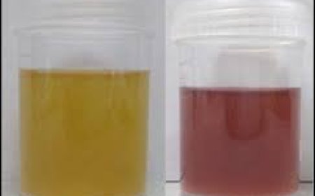 ପରିସ୍ରାର ରଙ୍ଗ ବାରମ୍ବାର ବଦଳୁଛି କି ?