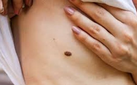 ଶରୀରର ଏହି ସ୍ଥାନରେ କଳାଜାଇ ଅଛି କି?