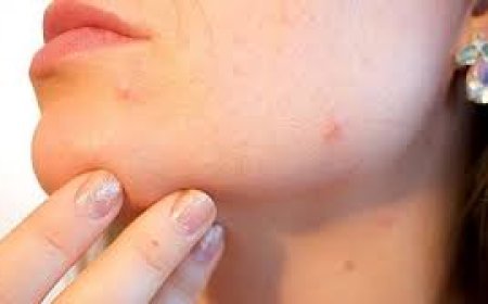 ଡାଇବେଟିସ୍‌ର ଲକ୍ଷଣ ଚର୍ମରେ କିପରି ଦେଖାଯାଏ?