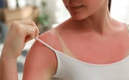 ସ୍କିନ୍‌ ଟ୍ୟାନ୍‌ ହଟାନ୍ତୁ