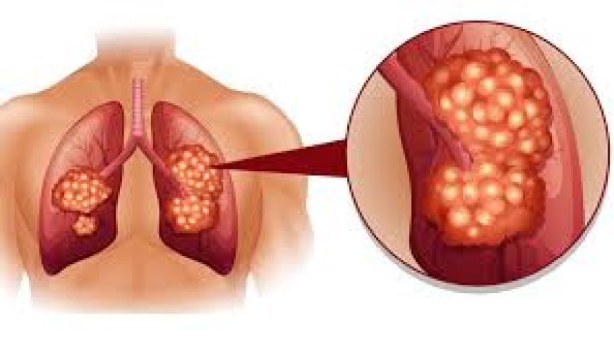 ଫୁସ୍‌ଫୁସ୍‌କୁ ଦୁର୍ବଳ କରିଦିଏ ଦୁଃଖ!